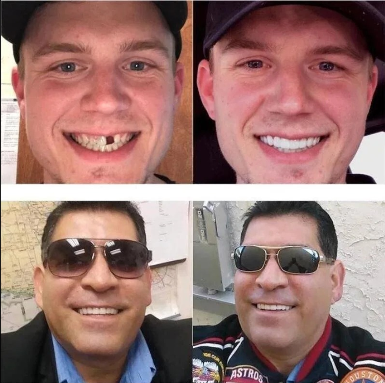 Protesi a scatto regolabili 5