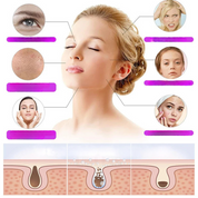 Donna con pelle chiara e diagramma di cura della pelle, evidenziando problemi cutanei come pori dilatati e acne. Soluzioni per pelle sana e luminosa.