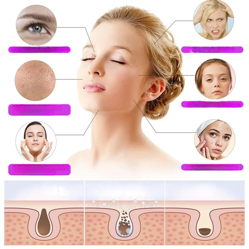 Donna con pelle chiara e diagramma di cura della pelle, evidenziando problemi cutanei come pori dilatati e acne. Soluzioni per pelle sana e luminosa.