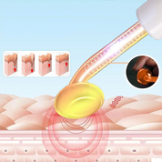 Illustrazione di un dispositivo per terapia a luce pulsata sulla pelle, mostra effetti di ringiovanimento cutaneo. Trattamento anti-età, cura della pelle.