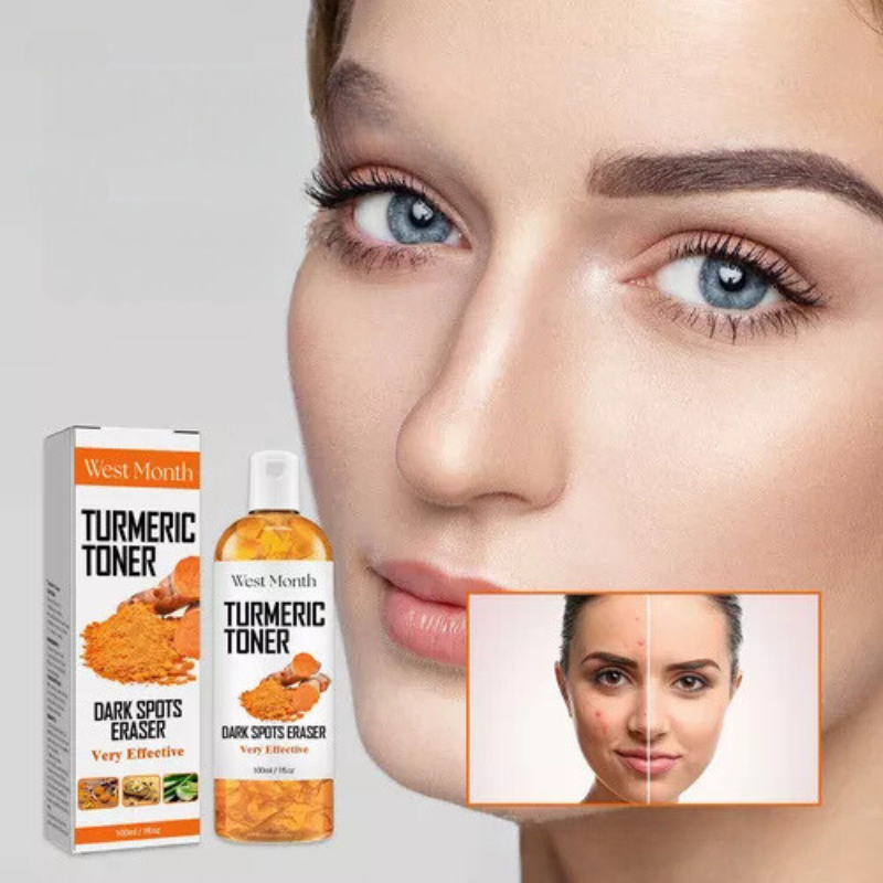 Donna con pelle liscia, flacone di tonico alla curcuma "West Month" per macchie scure, confezione visibile. Cura della pelle, bellezza, trattamento viso.