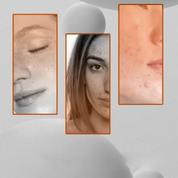 Immagine di volti femminili con diverse condizioni della pelle, tra cui lentiggini e acne. Focus su texture e imperfezioni cutanee.