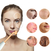 Dispositivo per la cura della pelle con elettrodo ad alta frequenza, trattamento acne, rughe, cicatrici, ringiovanimento viso, bellezza donna.