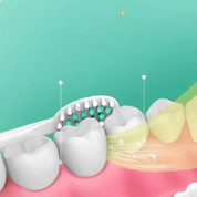Spazzolino da denti bianco pulisce denti bianchi su gengive rosa, sfondo verde. Igiene orale, cura dentale, salute denti.