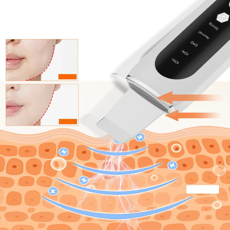 Dispositivo per la pulizia del viso ad ultrasuoni, esfoliazione pelle, rimozione impurità, miglioramento texture cutanea, cura del viso professionale.