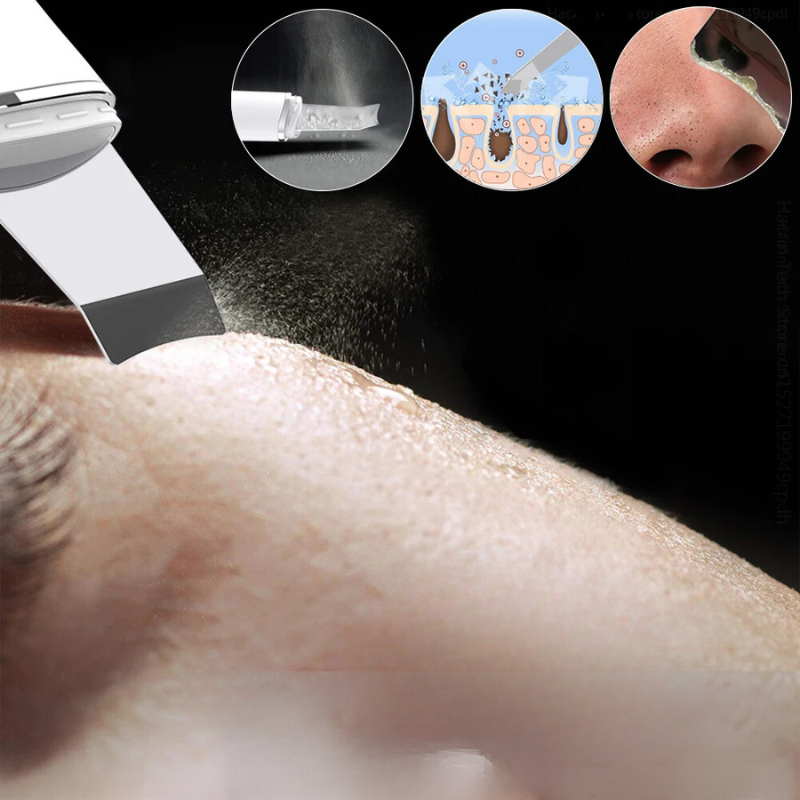 Dispositivo ultrasuoni per pulizia viso, rimozione punti neri, esfoliazione pelle, immagini dettagliate del processo, cura della pelle efficace.