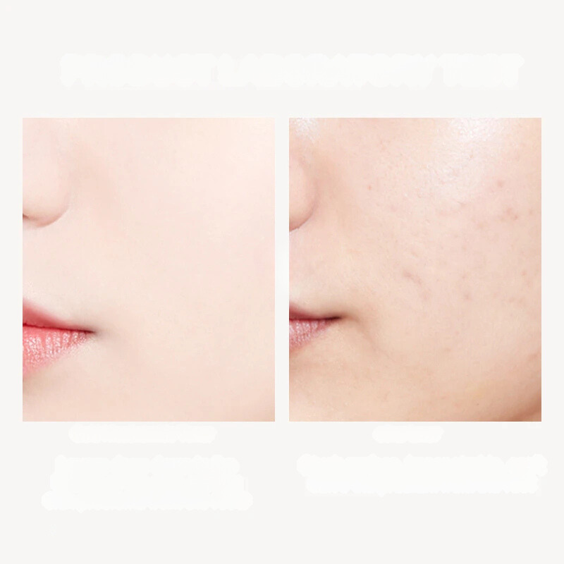 Confronto pelle viso: a sinistra pelle liscia e chiara, a destra pelle con imperfezioni e pori visibili. Risultati trattamento skincare.