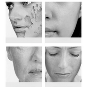 Quattro volti femminili in bianco e nero mostrano diverse condizioni della pelle: secca, liscia, rugosa e stressata. Cura della pelle, bellezza, dermatologia.