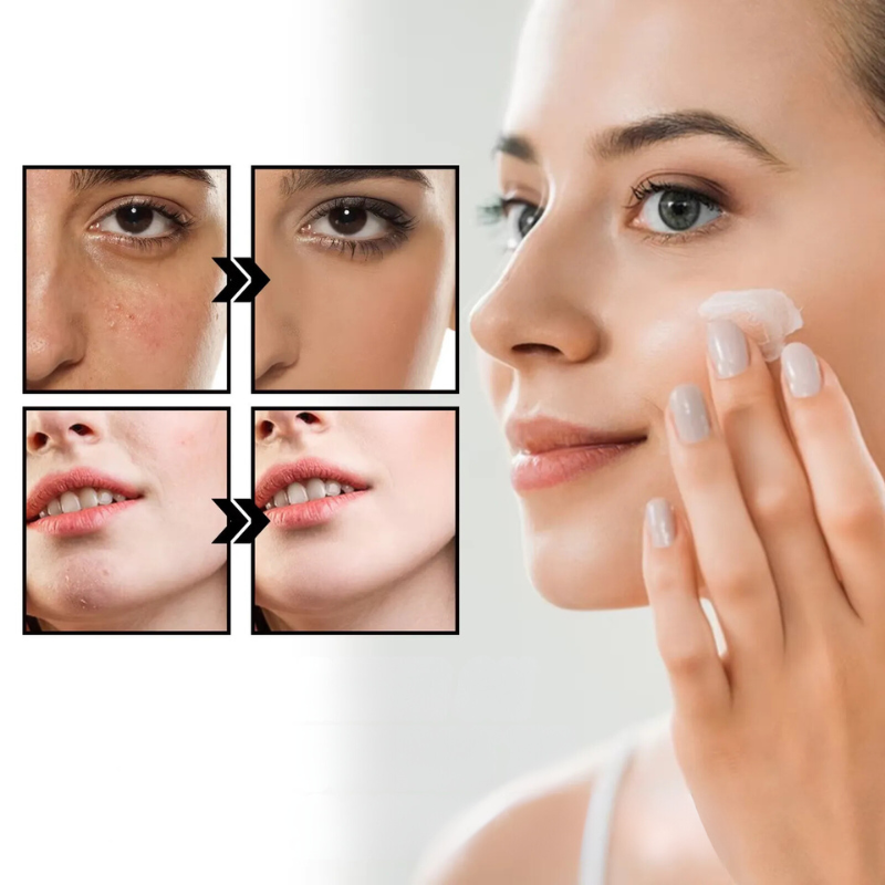 Donna applica crema viso, miglioramento pelle visibile. Prima e dopo trattamento skincare, riduzione imperfezioni. Cura della pelle, bellezza.