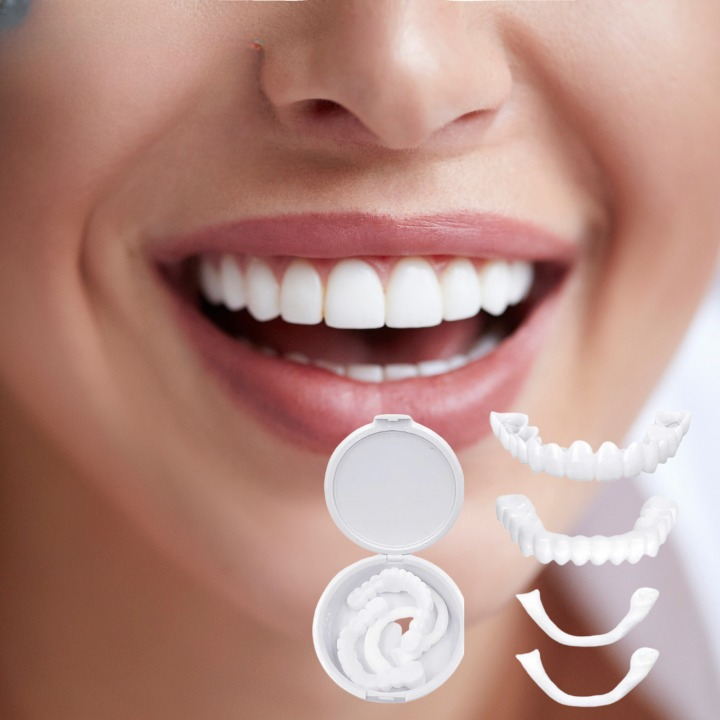 Sorriso con denti bianchi e allineatori dentali trasparenti in primo piano, confezione aperta. Cura dentale, estetica dentale, allineatori invisibili.