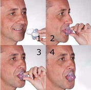 Dispositivo di stabilizzazione della lingua per l'apnea 2