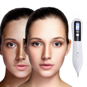 Penma laser Clearskinpro - non invasiva | Per la lentiggini, il tag della pelle, i punti, la talpa e la rimozione del tatuaggio a casa 3