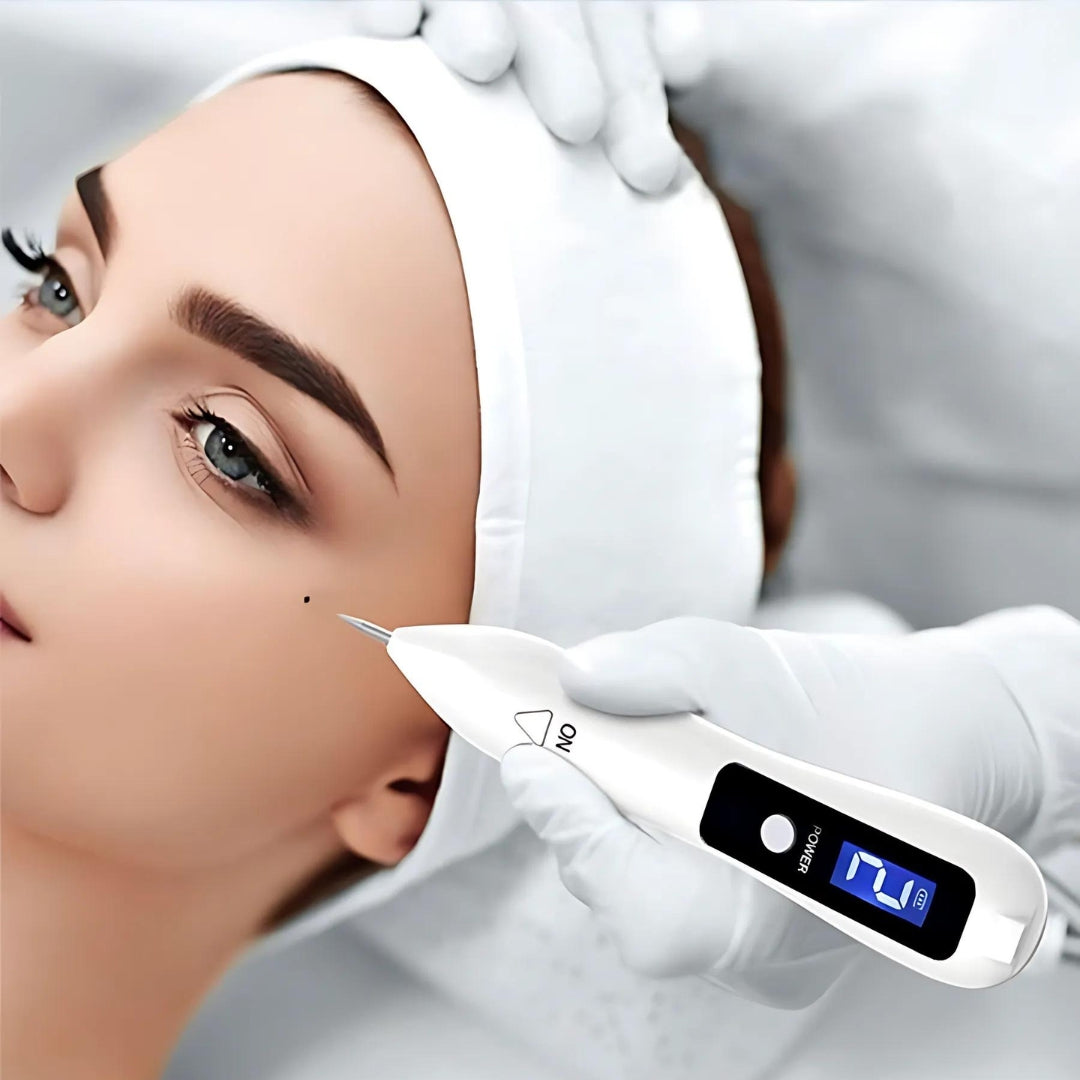 Penma laser Clearskinpro - non invasiva | Per la lentiggini, il tag della pelle, i punti, la talpa e la rimozione del tatuaggio a casa 4