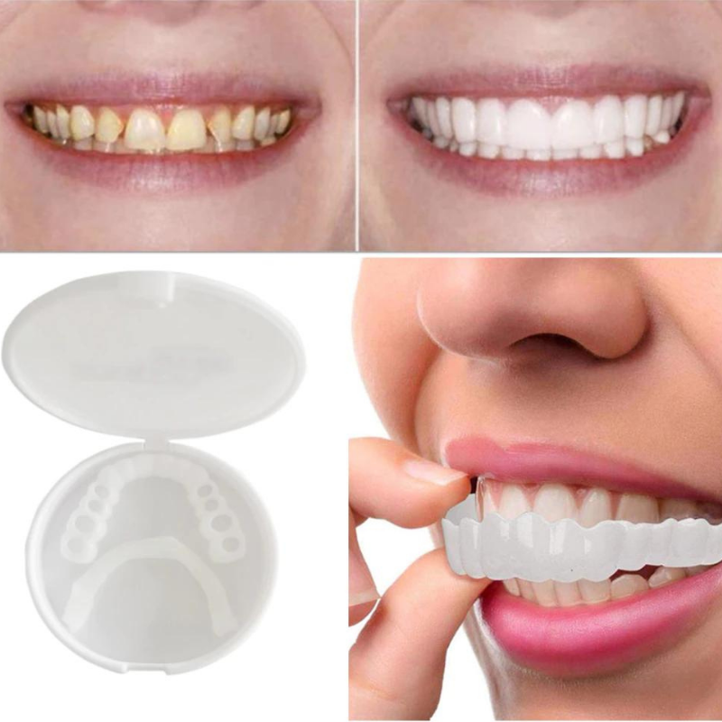 Sbiancamento denti: confronto prima e dopo, kit con mascherine dentali in custodia. Risultati visibili, sorriso bianco e luminoso.