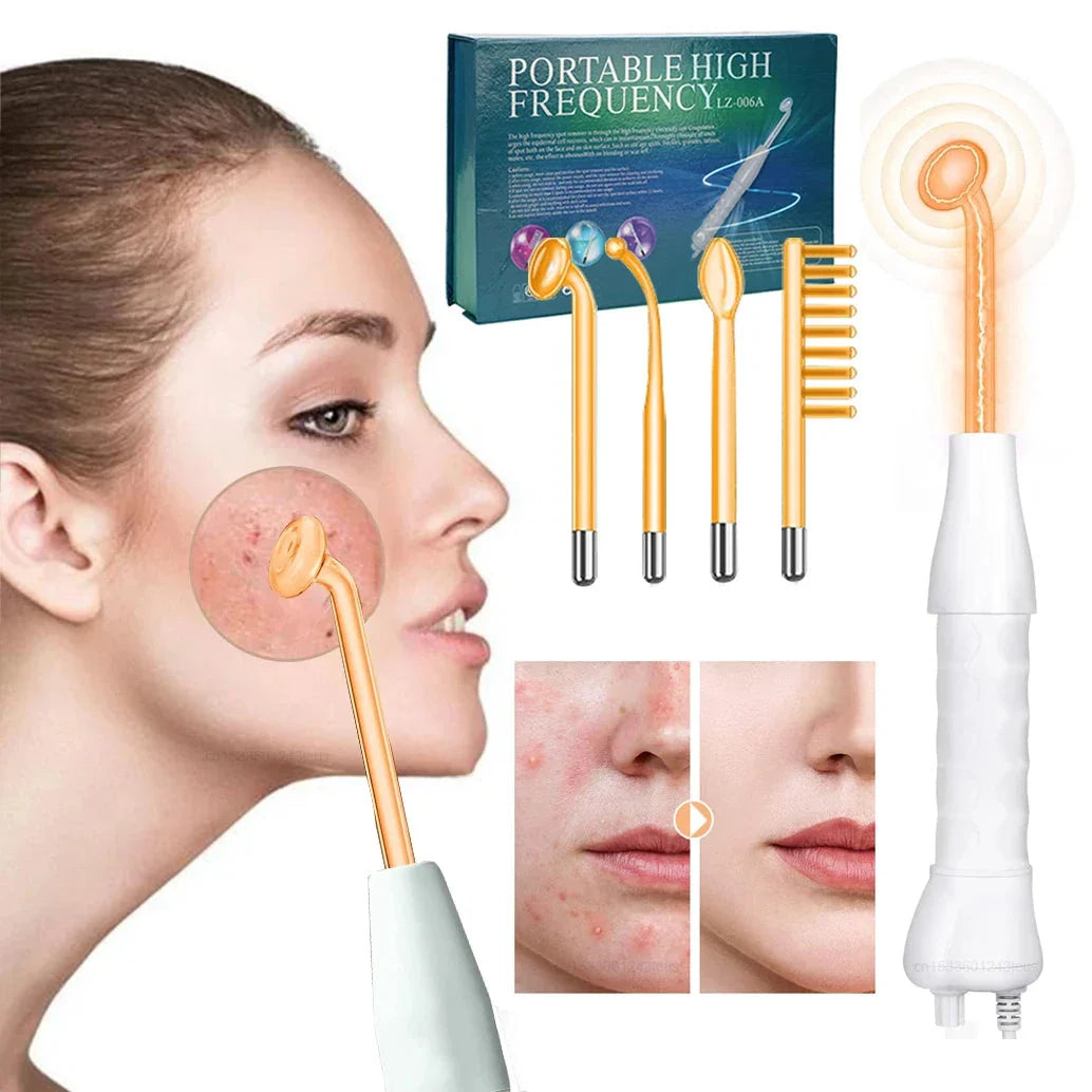 Dispositivo portatile ad alta frequenza per cura della pelle, con elettrodi arancioni, usato su viso femminile per acne. Kit bellezza viso.