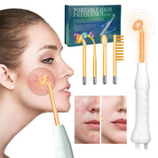 Dispositivo portatile ad alta frequenza per cura della pelle, con elettrodi arancioni, usato su viso femminile per acne. Kit bellezza viso.