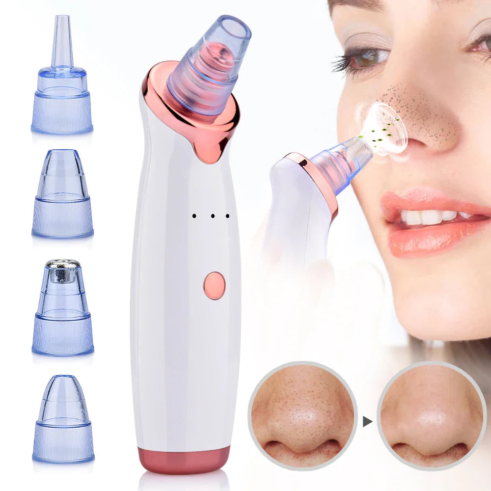 Dispositivo di aspirazione punti neri con testine intercambiabili, rimozione comedoni, cura della pelle, bellezza viso, pulizia pori, donna in uso.