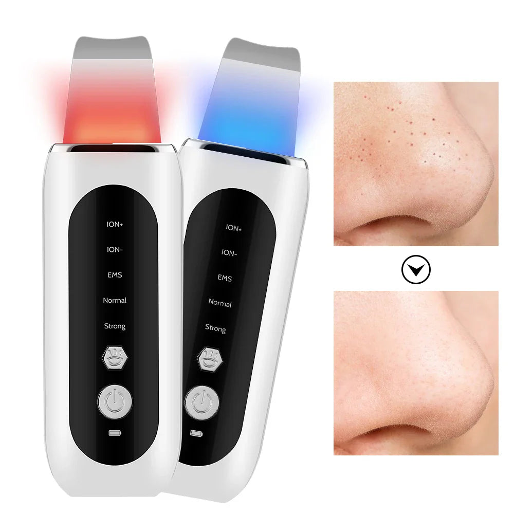 Dispositivo per pulizia viso ad ultrasuoni con luci LED rosse e blu, prima e dopo trattamento pori. Strumento skincare esfoliante e lifting.