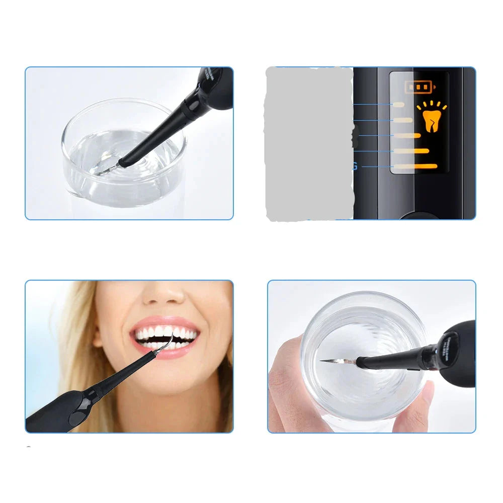 Dispositivo per pulizia dentale ad ultrasuoni, rimuove placca e tartaro. Include testina intercambiabile, display LED, uso domestico sicuro.