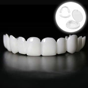 Trasformazione immediata del sorriso con Snap on Smile Veneers 0