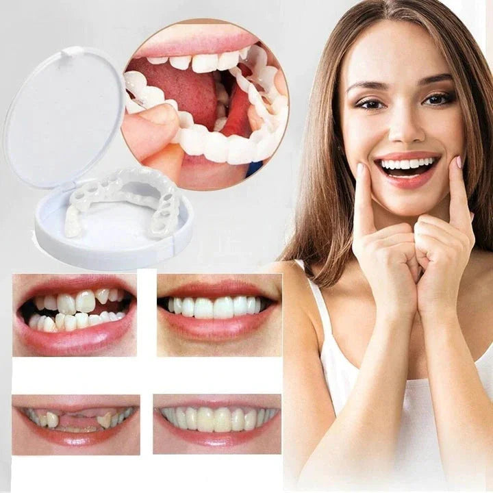 Trasformazione immediata del sorriso con Snap on Smile Veneers 1