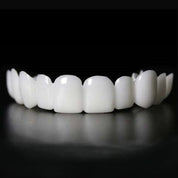 Trasformazione immediata del sorriso con Snap on Smile Veneers 2