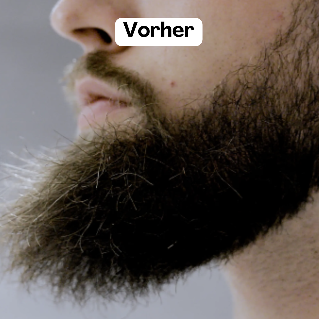 Beardmaster | Stiler di barba a ioni negativi wireless-5