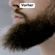 Beardmaster | Stiler di barba a ioni negativi wireless-5